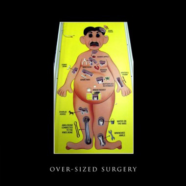 Over Sized Operation